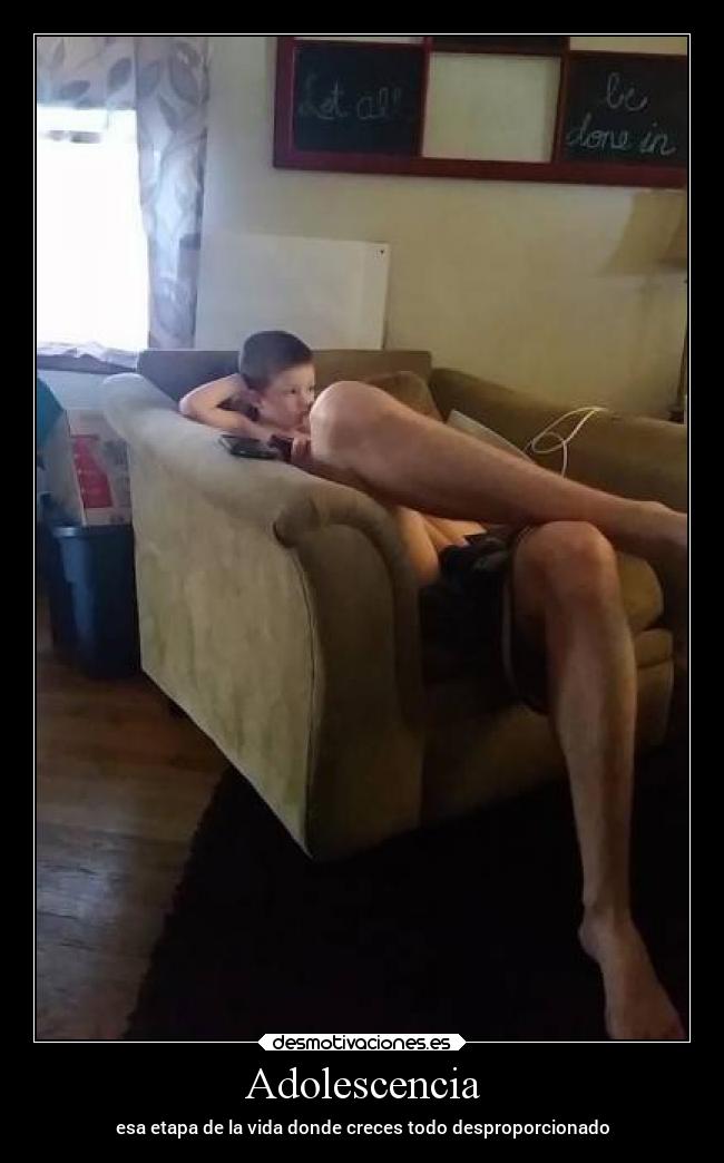 Adolescencia - esa etapa de la vida donde creces todo desproporcionado