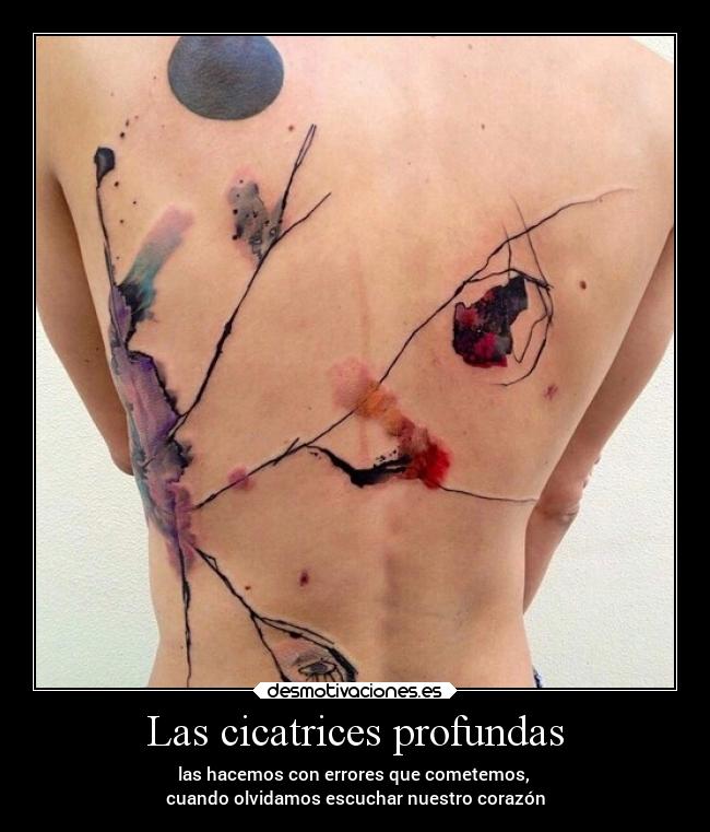 Las cicatrices profundas - las hacemos con errores que cometemos,
cuando olvidamos escuchar nuestro corazón