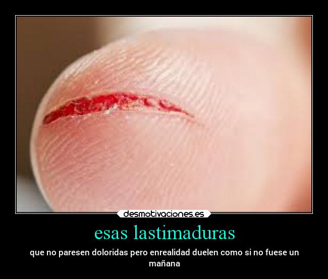 esas lastimaduras - 