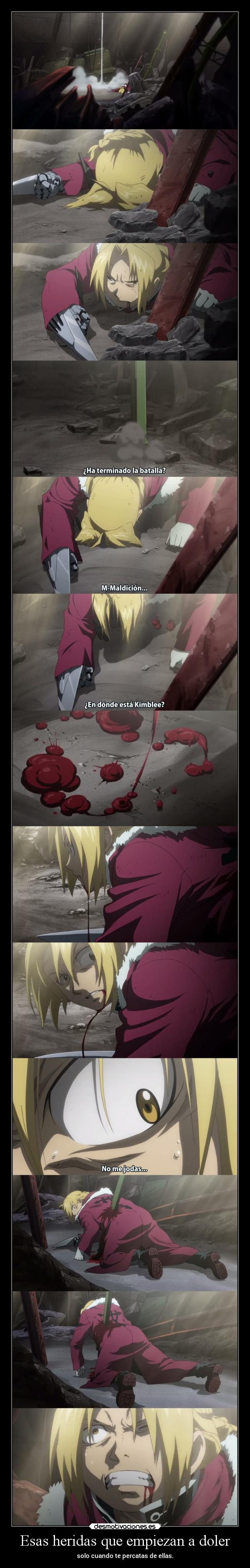 Esas heridas que empiezan a doler -