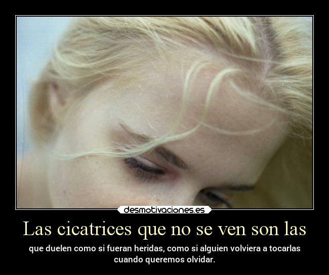 Las cicatrices que no se ven son las -