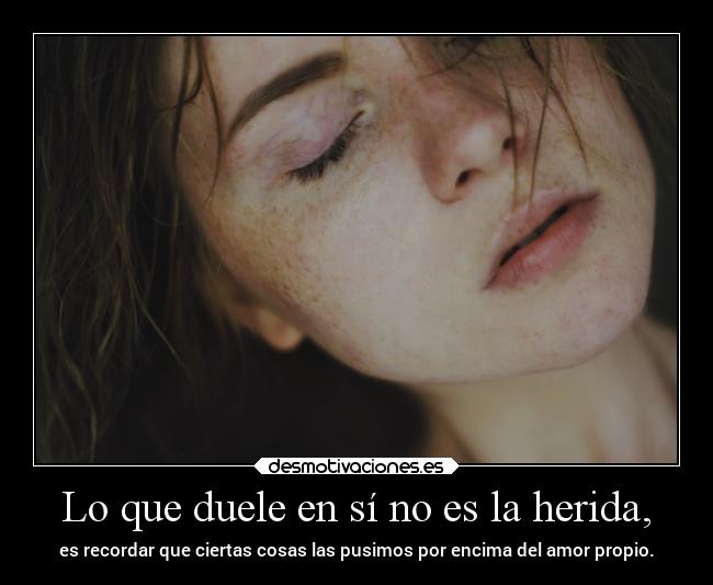 Lo que duele en sí no es la herida, - 