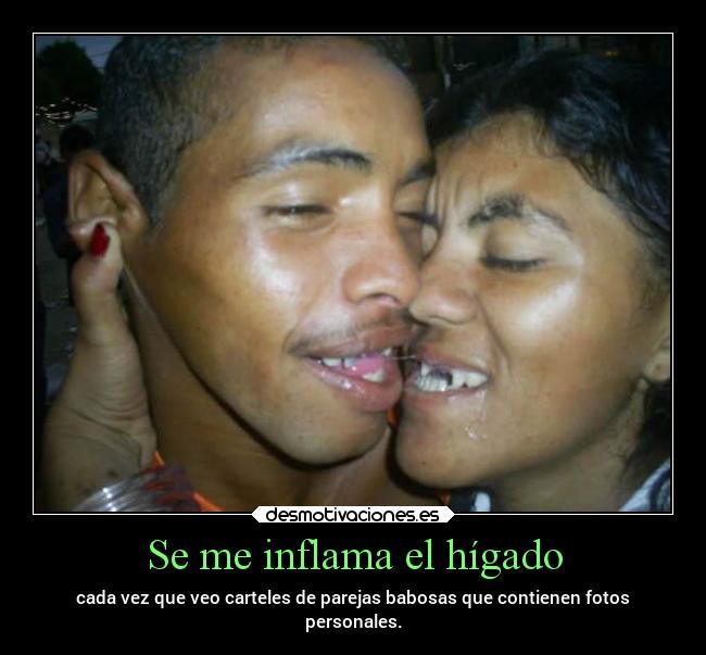 Se me inflama el hígado - cada vez que veo carteles de parejas babosas que contienen fotos
personales.