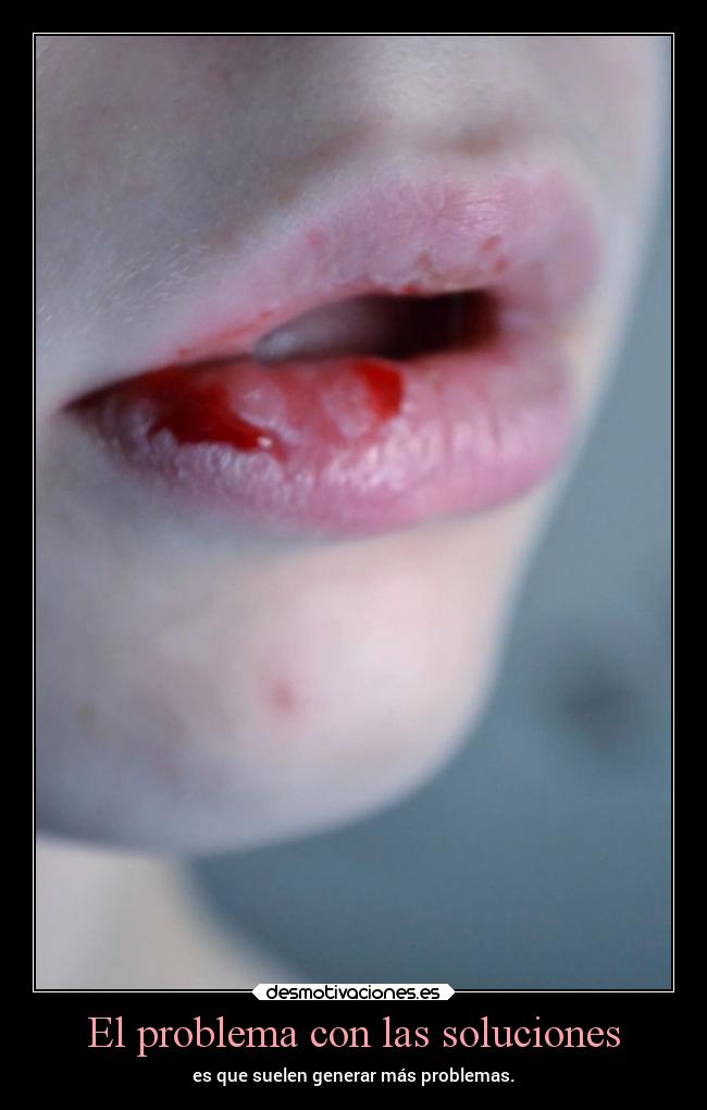 El problema con las soluciones - es que suelen generar más problemas.