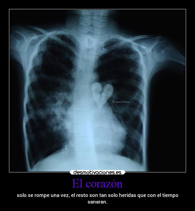 El corazón - solo se rompe una vez, el resto son tan solo heridas que con el tiempo
sanaran.