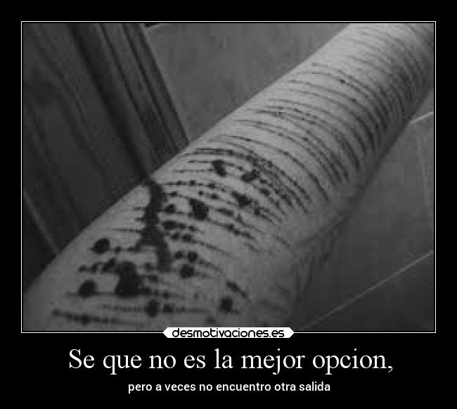 Se que no es la mejor opcion, - 