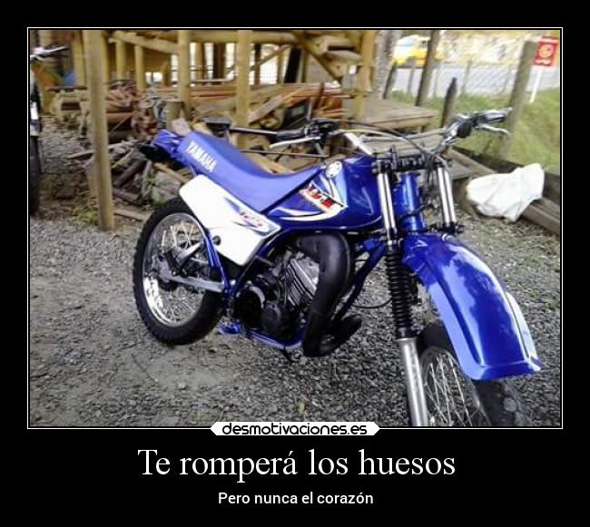 Te romperá los huesos - 