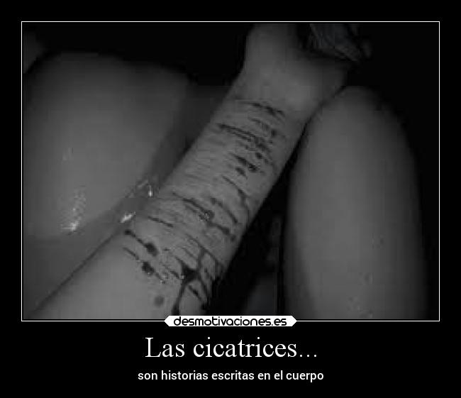 Las cicatrices... - 