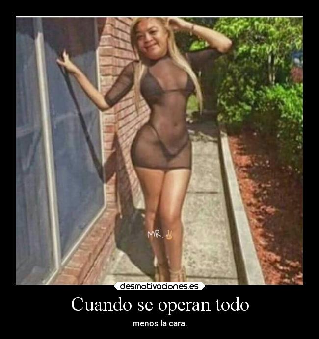 Cuando se operan todo - 