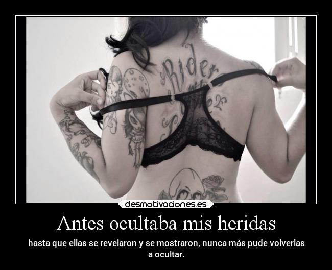 Antes ocultaba mis heridas - hasta que ellas se revelaron y se mostraron, nunca más pude volverlas
a ocultar.