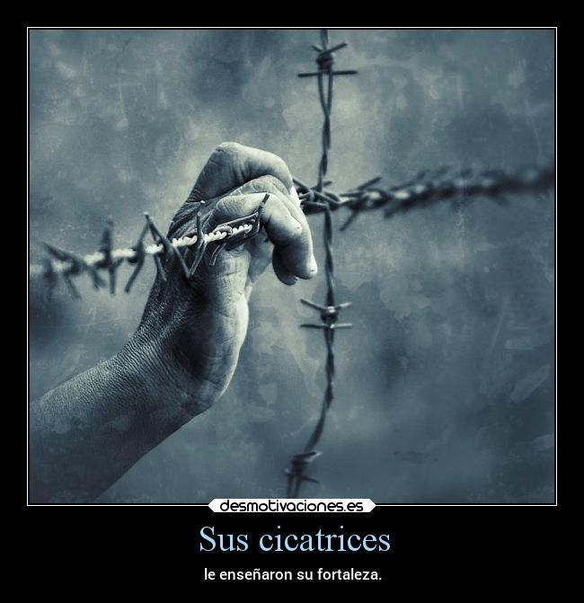 Sus cicatrices - 