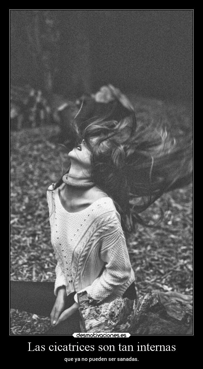 Las cicatrices son tan internas -