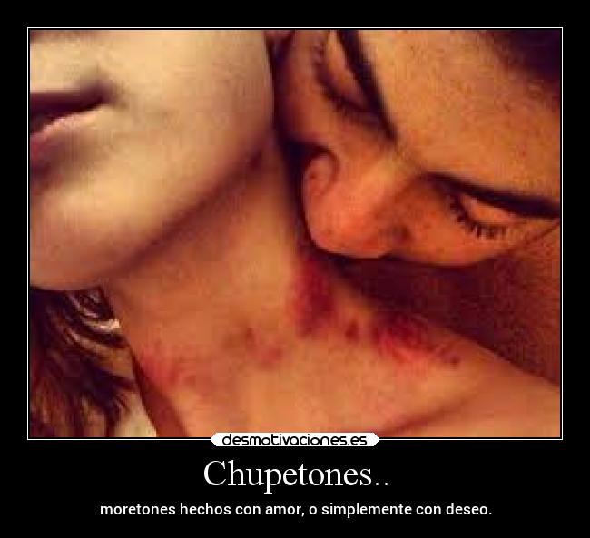 Chupetones.. - moretones hechos con amor, o simplemente con deseo.