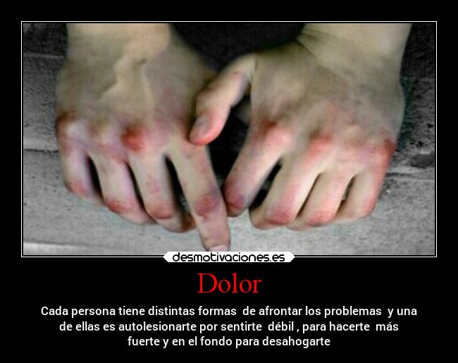 Dolor - Cada persona tiene distintas formas de afrontar los problemas y una
de ellas es autolesionarte por sentirte débil , para hacerte más
fuerte y en el fondo para desahogarte