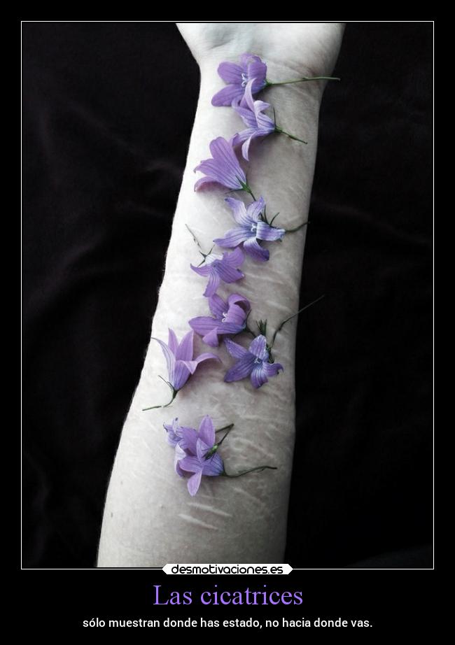 Las cicatrices - 