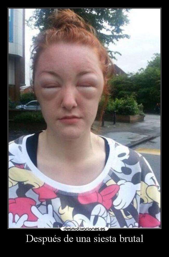 Después de una siesta brutal - 