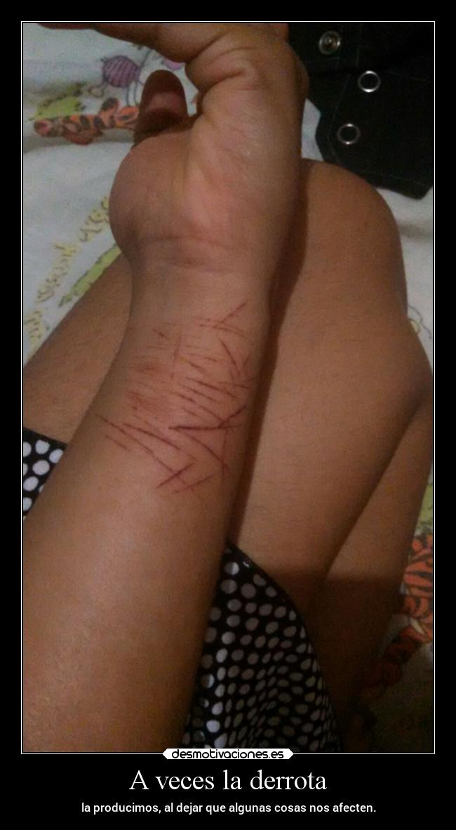 A veces la derrota - la producimos, al dejar que algunas cosas nos afecten.