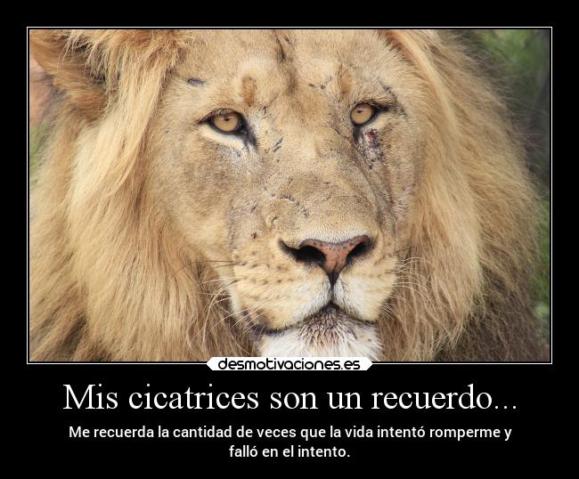 Mis cicatrices son un recuerdo... - 