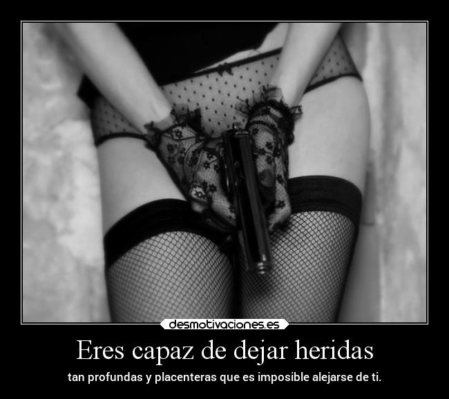 Eres capaz de dejar heridas -