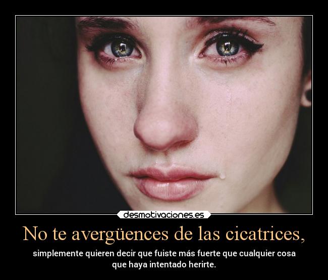 No te avergüences de las cicatrices, -