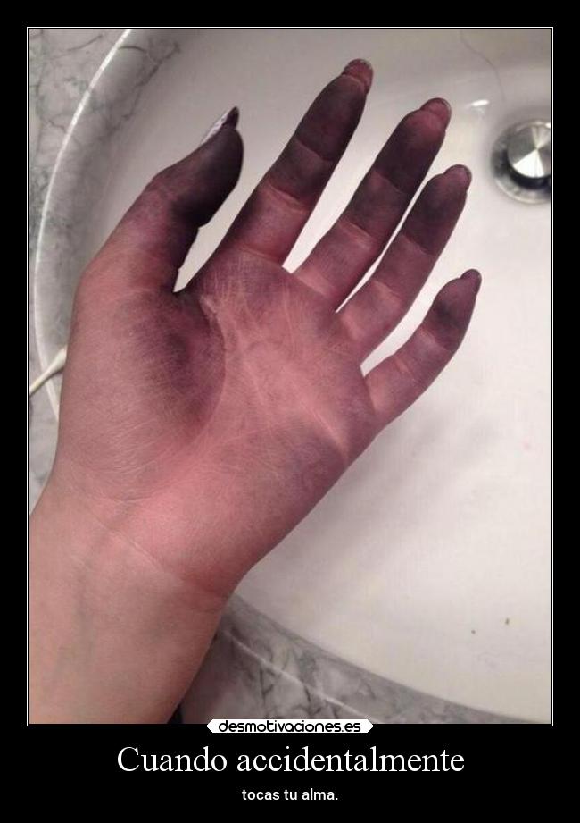 Cuando accidentalmente - 