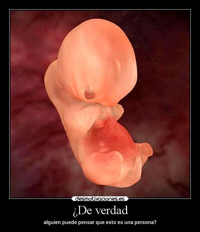 ¿De verdad - 