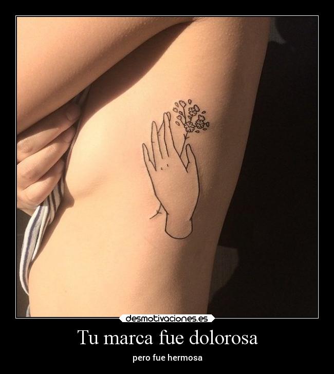 Tu marca fue dolorosa - 