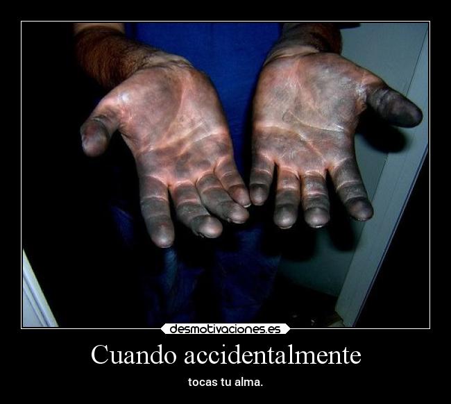 Cuando accidentalmente - 