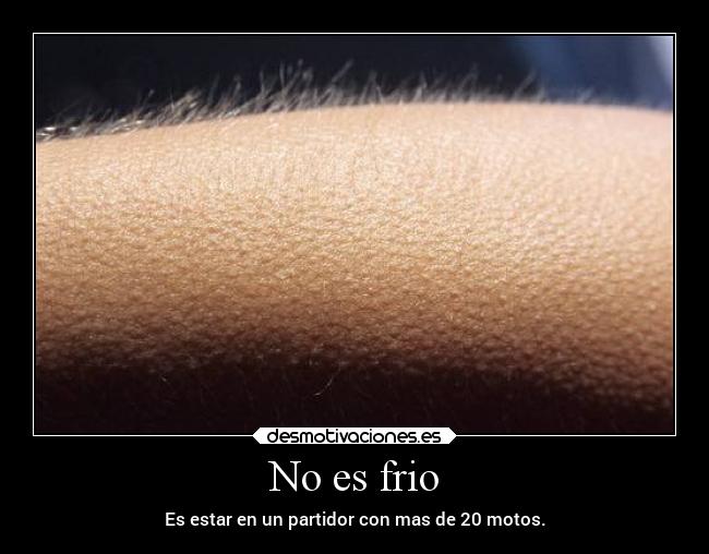 No es frio - Es estar en un partidor con mas de 20 motos.