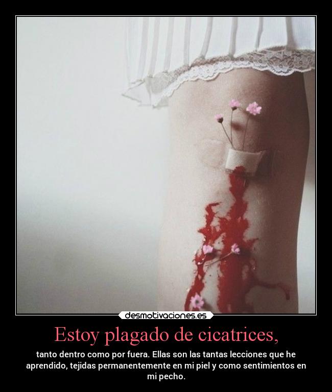 Estoy plagado de cicatrices, - 