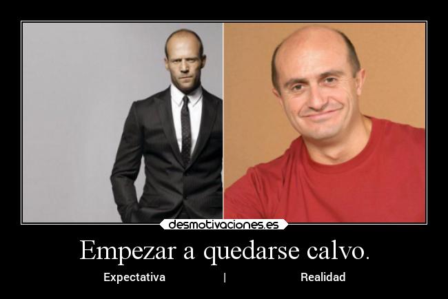 Empezar a quedarse calvo. - Expectativa | Realidad