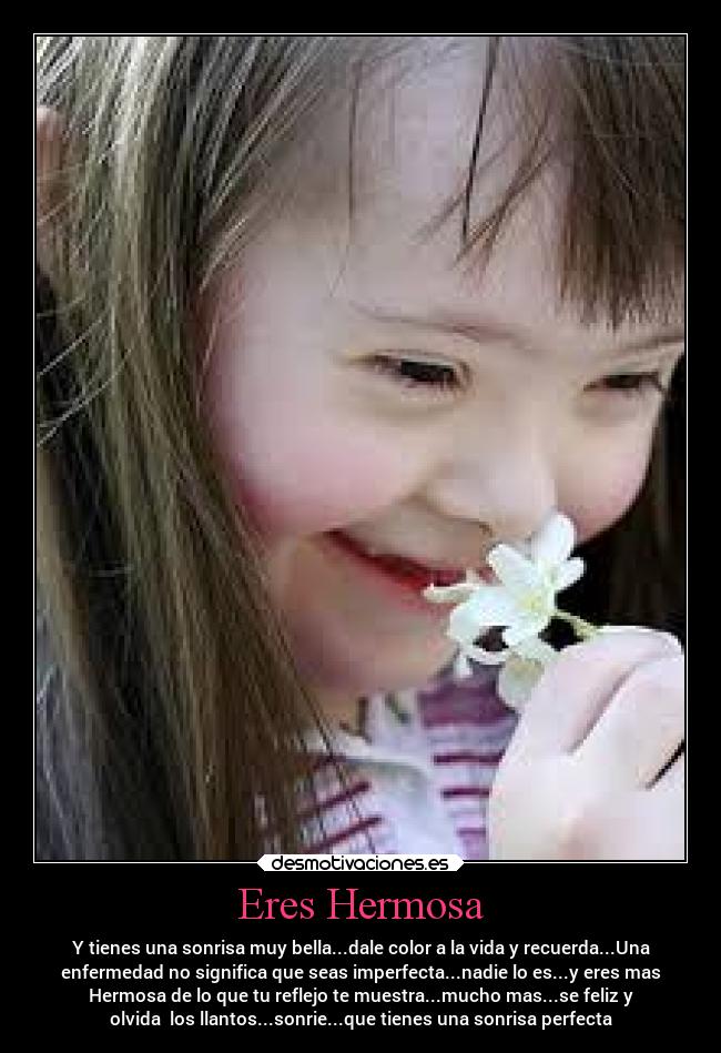 Eres Hermosa - Y tienes una sonrisa muy bella...dale color a la vida y recuerda...Una
enfermedad no significa que seas imperfecta...nadie lo es...y eres mas
Hermosa de lo que tu reflejo te muestra...mucho mas...se feliz y
olvida los llantos...sonrie...que tienes una sonrisa perfecta