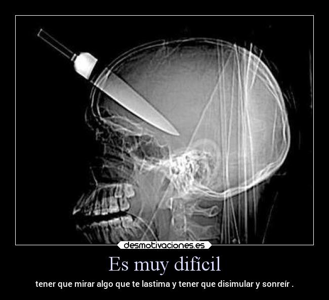 Es muy difícil - tener que mirar algo que te lastima y tener que disimular y sonreír .