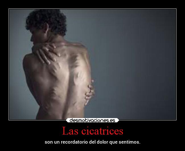 Las cicatrices - 
