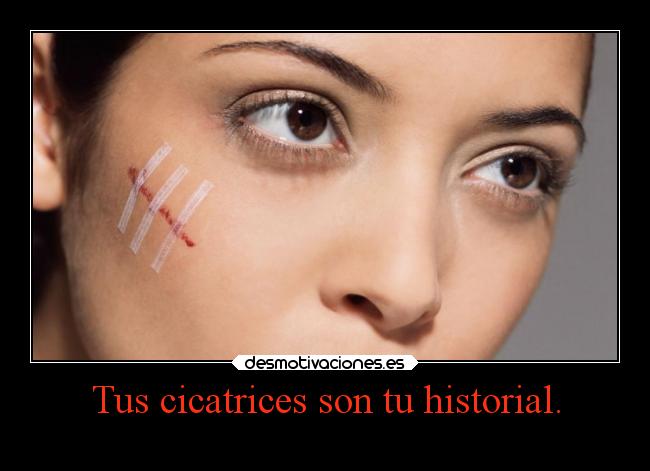 Tus cicatrices son tu historial. - 
