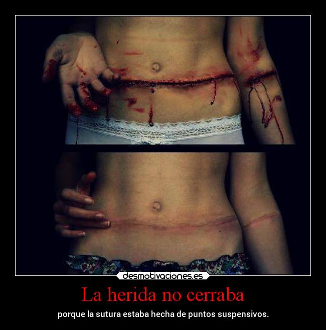 La herida no cerraba - porque la sutura estaba hecha de puntos suspensivos.