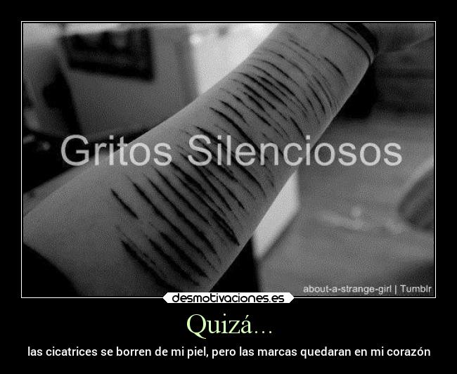 Quizá... - las cicatrices se borren de mi piel, pero las marcas quedaran en mi corazón