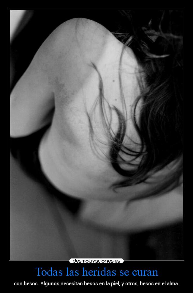 Todas las heridas se curan - 