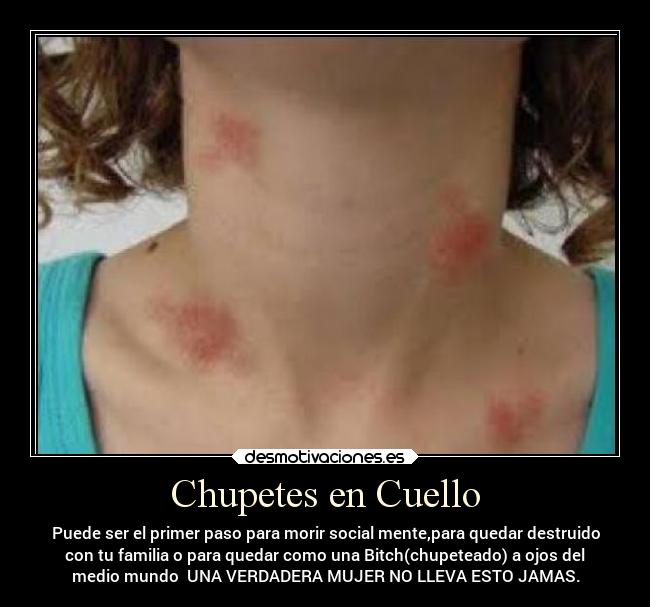 Chupetes en Cuello -