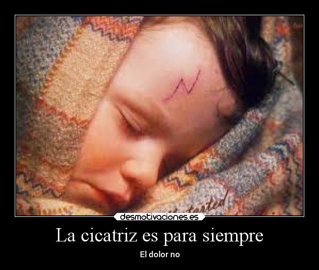La cicatriz es para siempre -