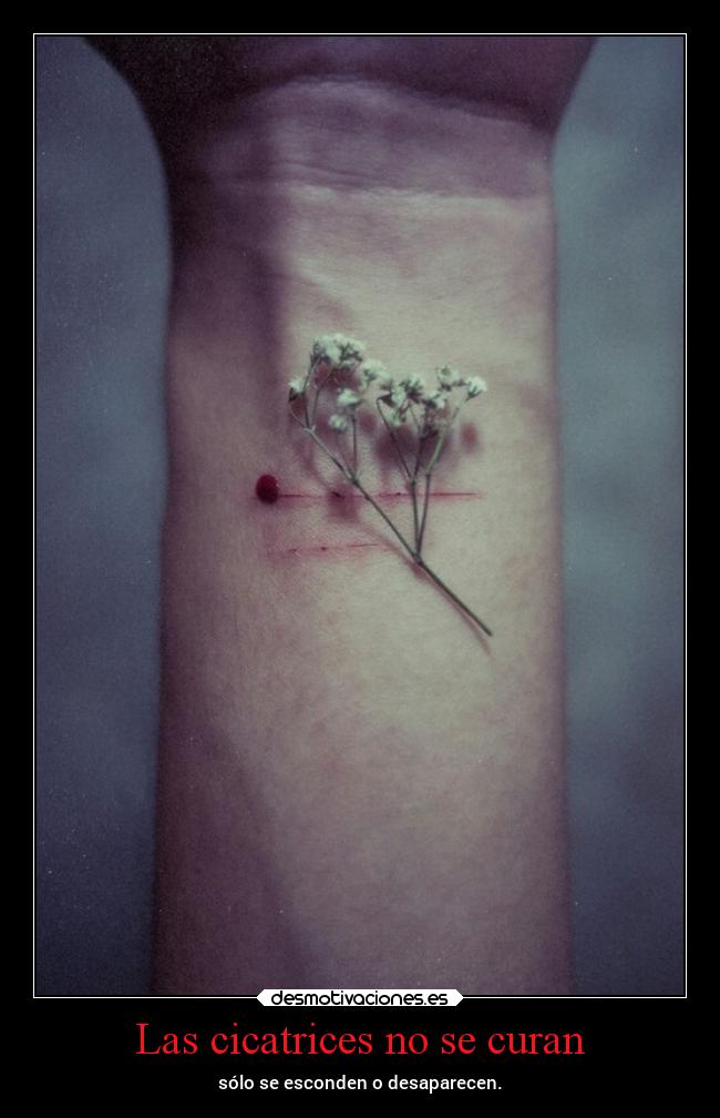 Las cicatrices no se curan - 