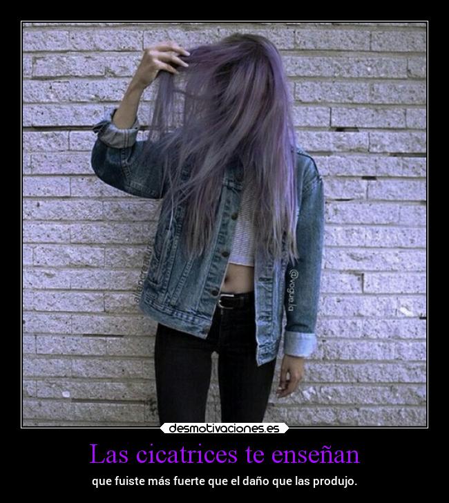 Las cicatrices te enseñan - que fuiste más fuerte que el daño que las produjo.