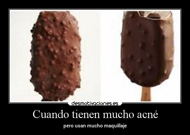 Cuando tienen mucho acné -