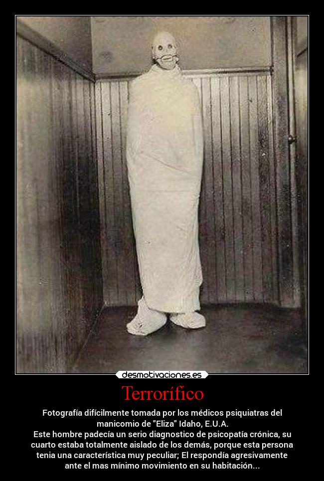 Terrorífico - Fotografía difícilmente tomada por los médicos psiquiatras del
manicomio de Eliza Idaho, E.U.A.
Este hombre padecía un serio diagnostico de psicopatía crónica, su
cuarto estaba totalmente aislado de los demás, porque esta persona
tenia una característica muy peculiar; El respondía agresivamente
ante el mas mínimo movimiento en su habitación...
