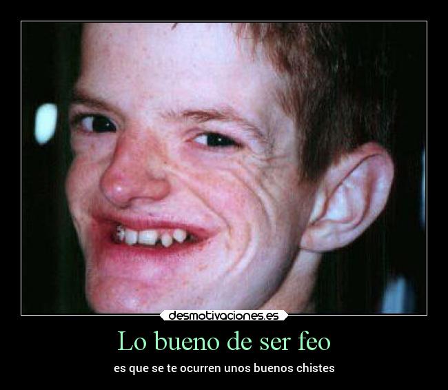 Lo bueno de ser feo -