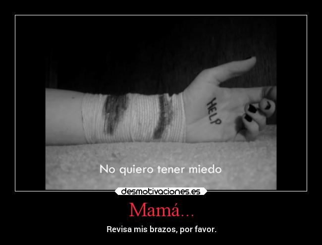 Mamá... - Revisa mis brazos, por favor.