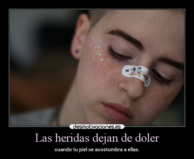 Las heridas dejan de doler - 