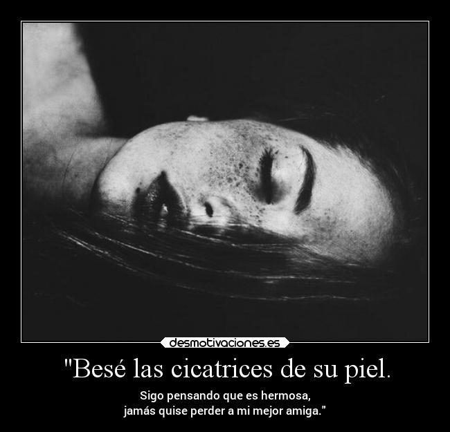 carteles dolor cortes perdoname silees esto sinzdezorra desmotivaciones