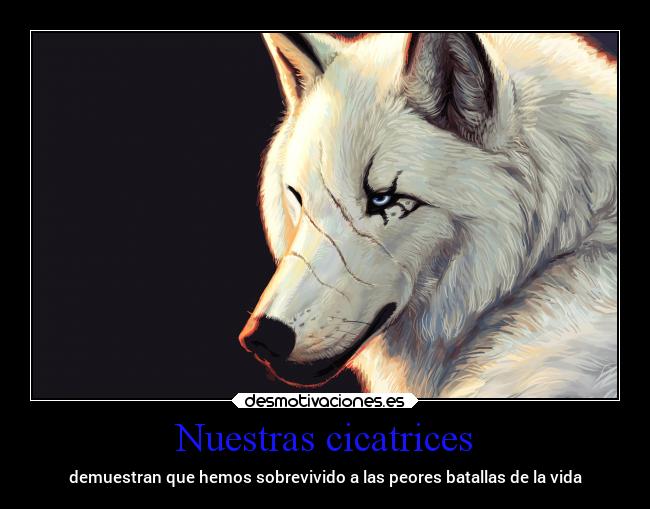 Nuestras cicatrices - demuestran que hemos sobrevivido a las peores batallas de la vida