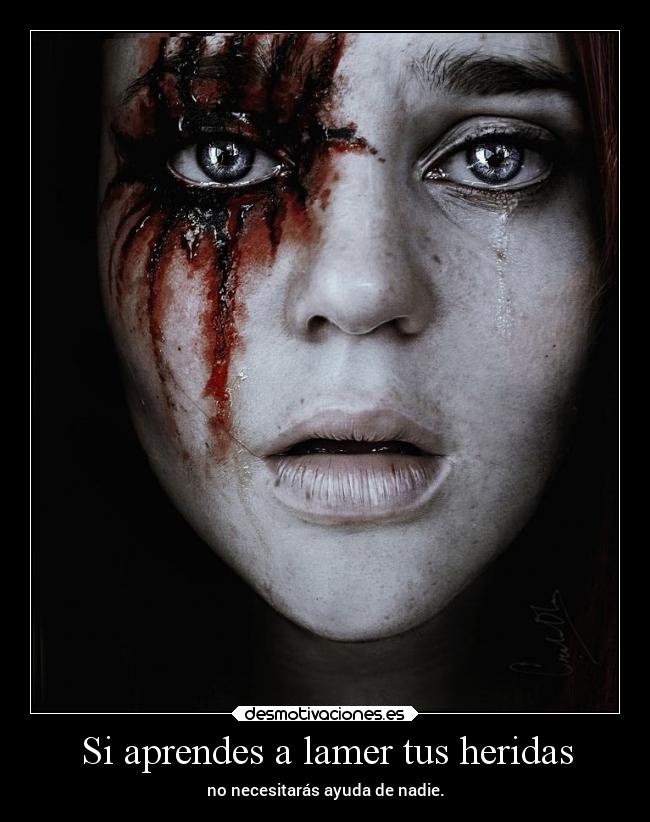 Si aprendes a lamer tus heridas - no necesitarás ayuda de nadie.